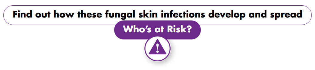 Find out how these fungal skin infections develop and spread